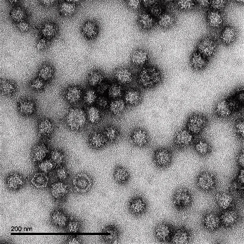 Like virus. Virus like Particles orf2 PCV-2. Tem images.