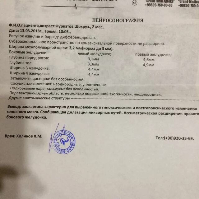 Нсг мозга. Нейросонография новорожденных протокол УЗИ. НСГ головного мозга норма у грудничка. Ультразвуковое исследование головного мозга - нейросонография (НСГ). Протокол УЗИ головного мозга у новорожденного.