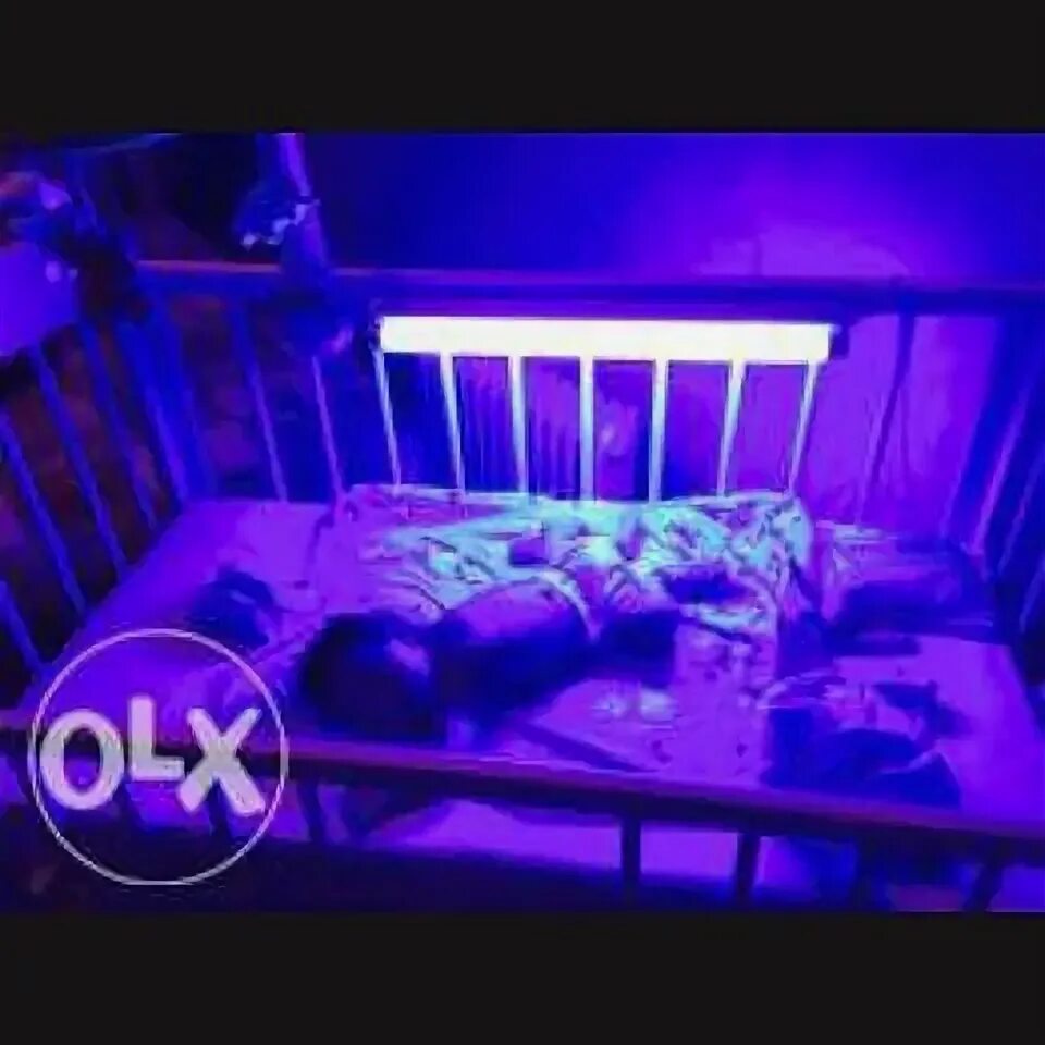 Сколько лежат под лампой при желтушке новорожденных