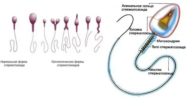 Где образуются спермии