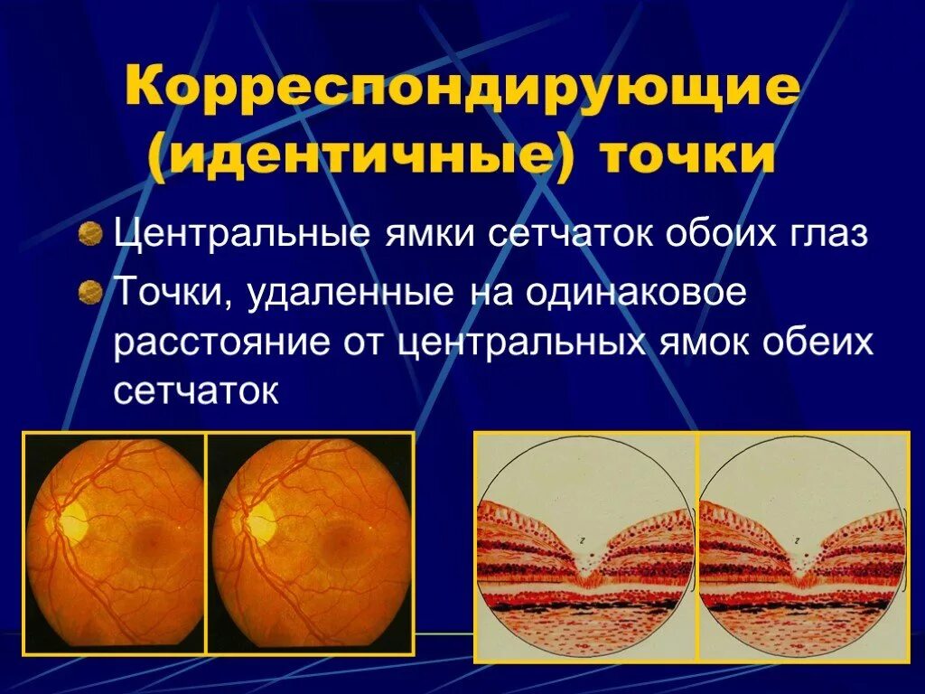 Центральная ямка функции. Корреспондирующие точки сетчатки. центральная ямка сетчатки. центральная ямка глаза функции. строение глаза центральная ямка.