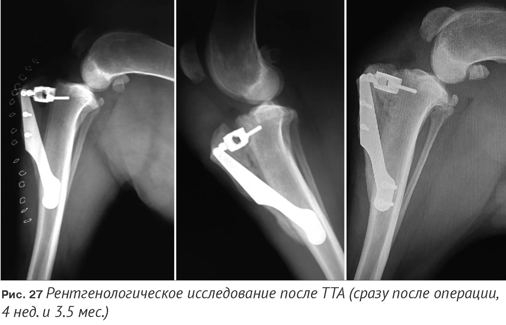 Разрыв связки у собаки. ПКС У собаки операция TPLO. Остеотомия коленного сустава у собаки. Разрыв ПКС У собак операции.