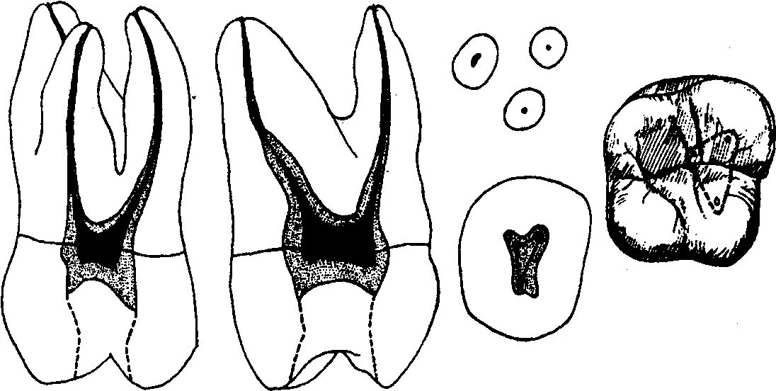 Первый моляр верхней челюсти. Первый моляр верхней челюсти анатомия. Третий моляр верхней челюсти анатомия. 1 Моляр нижней челюсти каналы. Первый моляр верхней челюсти корни.