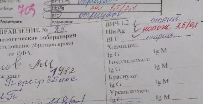 Кровь на HBS, HCV антиген. AG В анализе крови. HBSAG анализ. Исследование HBSAG что это. Вич hcv hbsag