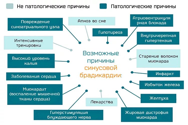 Почему у мужчины низкий пульс. Синусовая брадикардия причины. Редкий пульс причины. Брадикардия причины возникновения у женщин. Брадикардия сердца у взрослых причины.