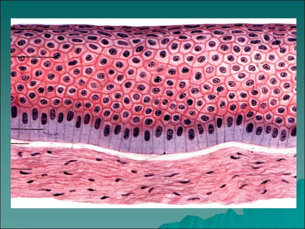 Плотный наблюдаться. Плоский неороговевающий эпителий. Многослойный плоский неороговевающий эпителий гистология. Однослойный плоский неороговевающий эпителий препарат. Слои многослойного плоского эпителия.
