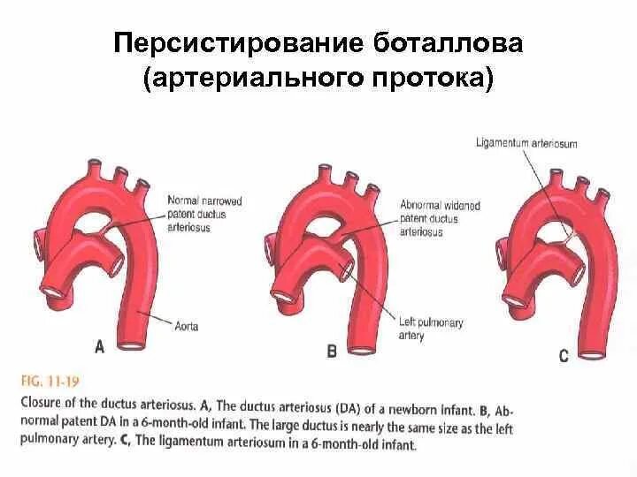 Персистировать это