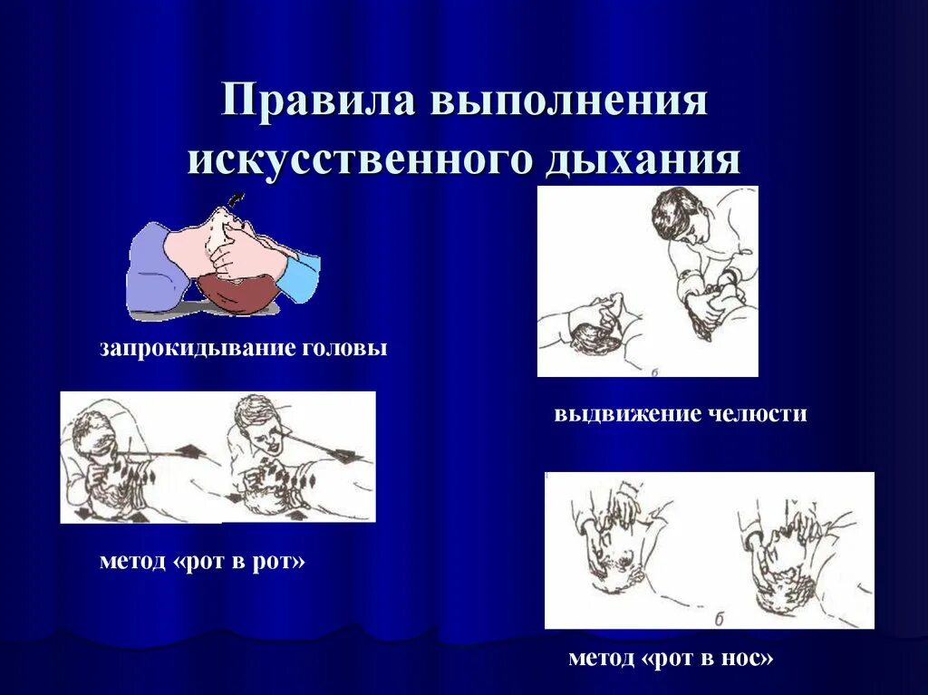 Частота проведения искусственного дыхания в минуту. Порядок выполнения искусственного дыхания. Метод при проведении искусственного дыхания. Способы выполнения искусственного дыхания. Правила выполнения искусственного дыхания.