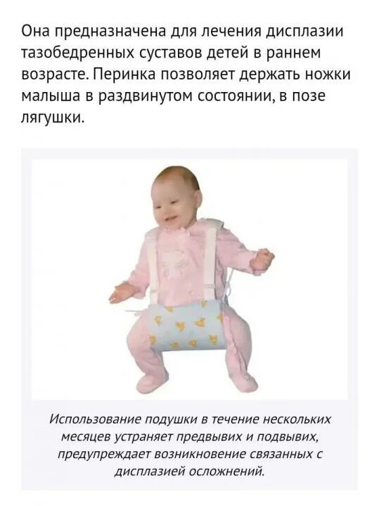 Электрофорез при дисплазии. Шина при дисплазии тазобедренных суставов у новорожденных. дисплазия тазобедренных суставов в 2 года. симптомы дисплазии тазобедренных суставов у ребенка 6 месяцев. дисплазия тазобедренных суставов у новорожденных 1 годик.