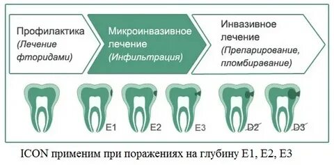 После лечения зуба можно в баню