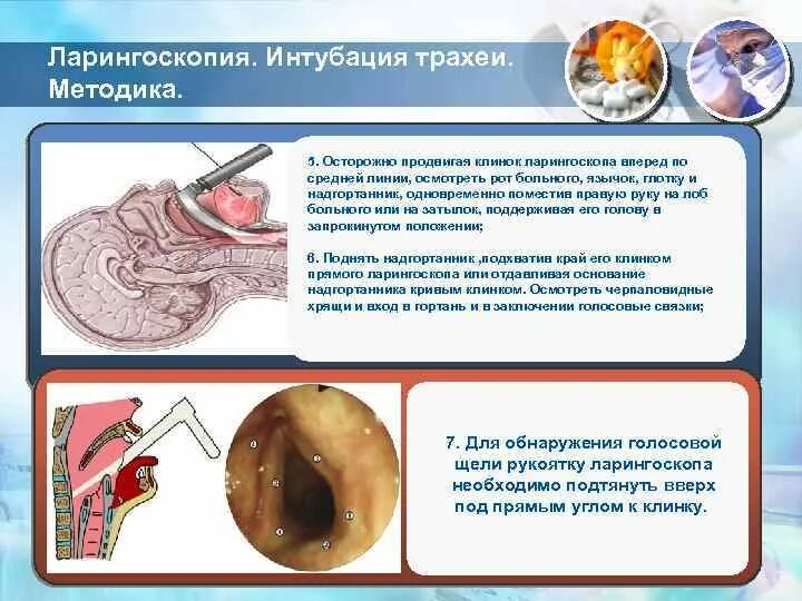 Ларингоскопия как проводится процедура