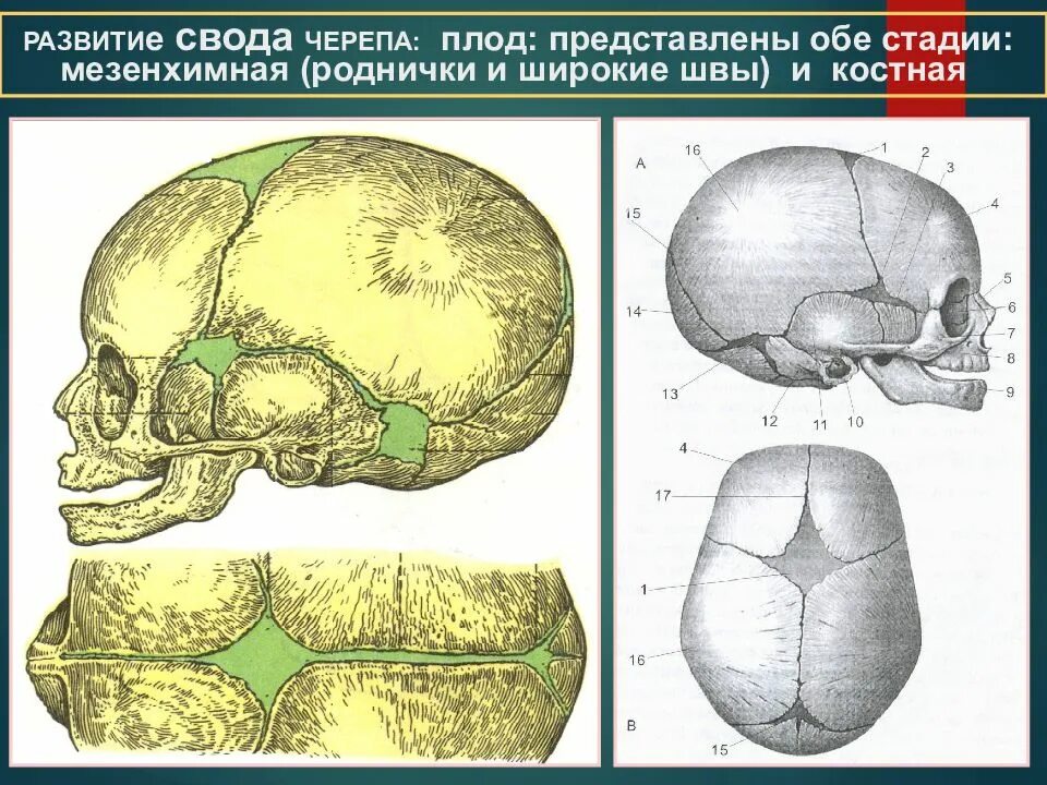 Строение черепа плода кости швы роднички. Швы черепа плода и роднмчкм. Стреловидный шов черепа у плода.