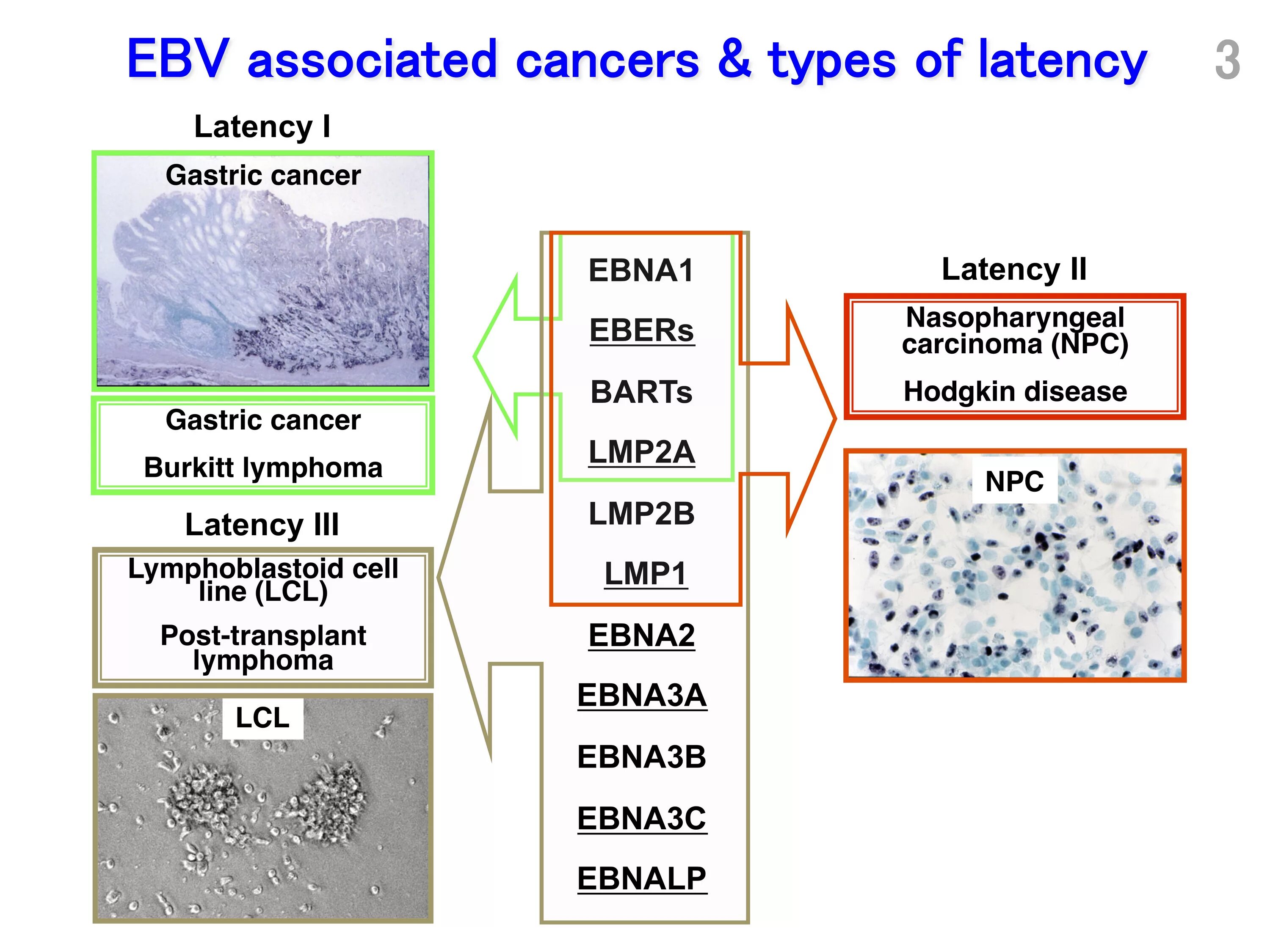 Epstein barr virus ebna. Вирус Эпштейна Барр EBNA. Остров Эпштейна на карте. Вирус Эпштейна Барр электронная микроскопия. Вирус Эпштейна-Барр патогенез.