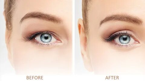Instant Eye Lift: Achieve a Youthful and Refreshed Look with Non-Surgical Solutions