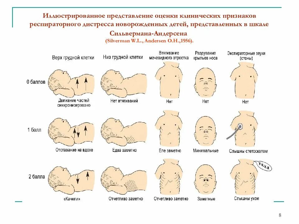 Шкала сильвермана. Сильверман шкала у новорожденных. Шкала Сильвермана для недоношенных. Шкала Сильвермана для новорожденных недоношенных. Шкала Сильвермана Андерсена для новорожденных.