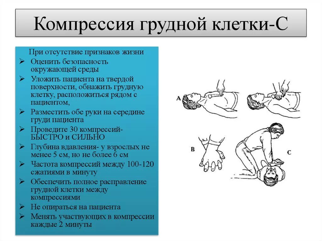 Сдавлениегрудной клетк. Компрессия грудной клетки. Компрессия груж клетки. Признак эффективности компрессии грудной клетки. Сжатие груди