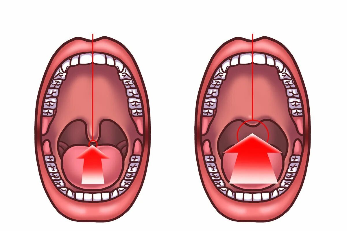 подъем мягкого неба. подъем мягкого неба. мышца, напрягающая нёбную занавеску (m. подъем мягкого неба. небный апоневроз мягкого неба.