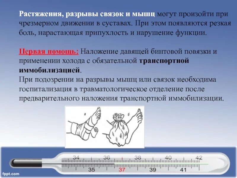 Растяжение связок и мышц. Первая медицинская помощь при разрывах связок и мышц — это:. Движения в суставе при растяжении s 0-0-100.