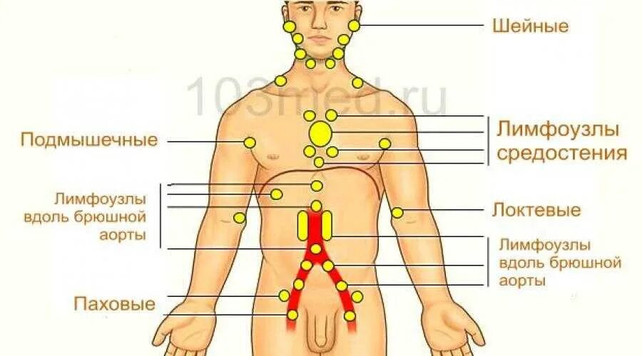 Куда воняет. Паховые лимфоузлы расположение схема. Лимфоузлы паховые где находятся схема. Паховые лимфоузлы схема. Лимфоузлы у мужчин в паховой области расположение.
