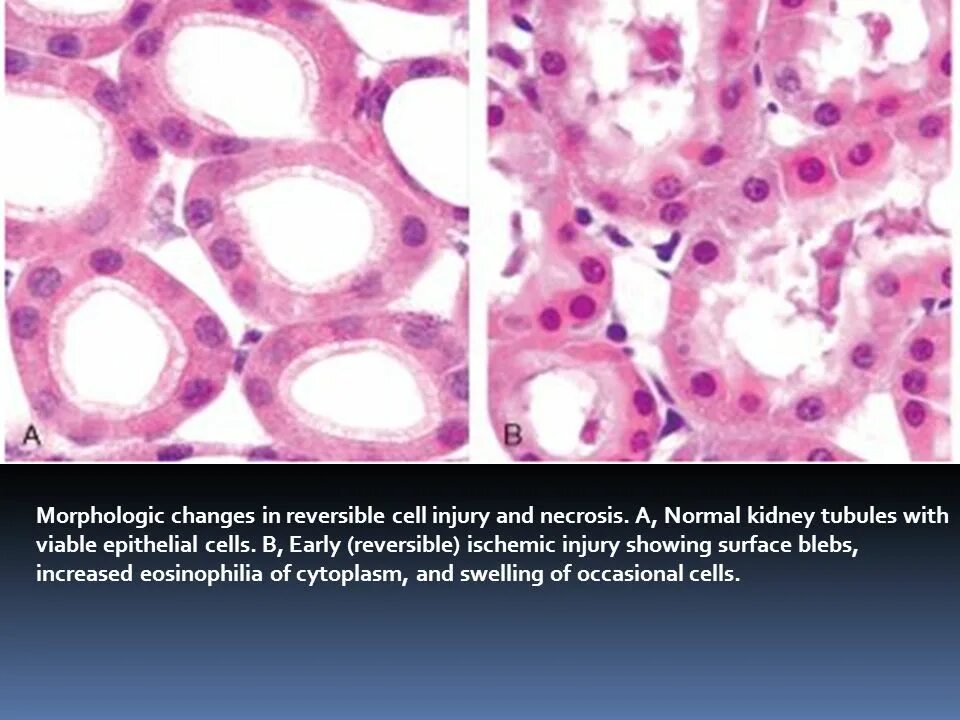 Reversed cell