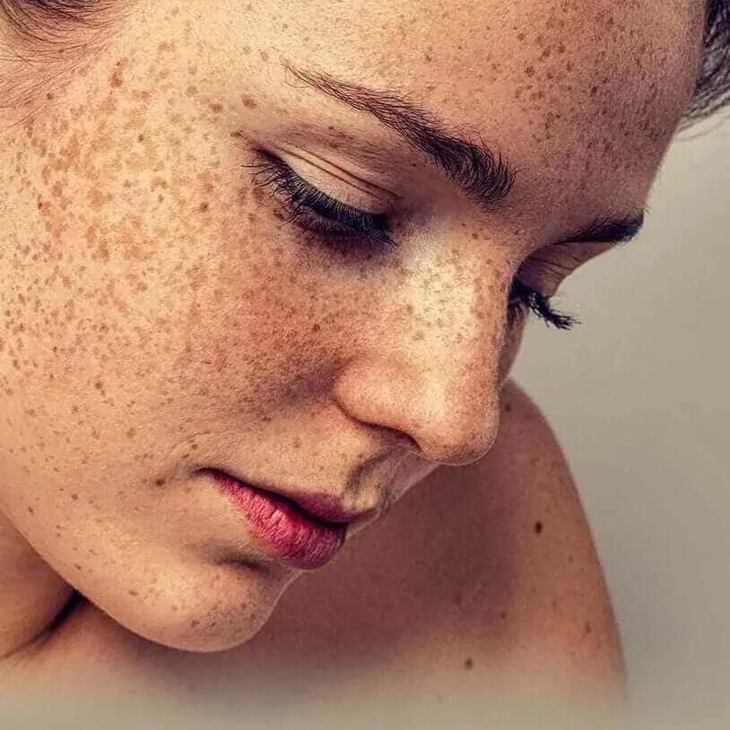 Problem skin. Problem skin