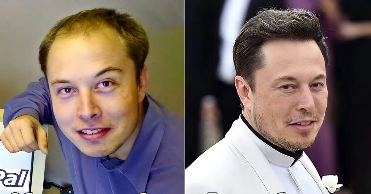Маск до и после. Elon musk before. элон маск в молодости. илон маск лысый. elon musk hair.