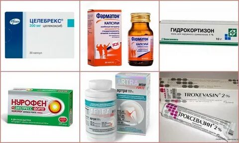 Что принимать при коксартрозе