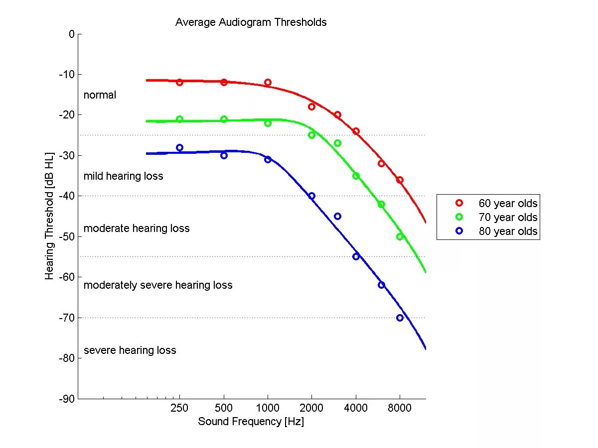 On average hear. Age hearing loss. Hearing Frequency age. Hearing loss in men age Chart. Hearing loss statistics.