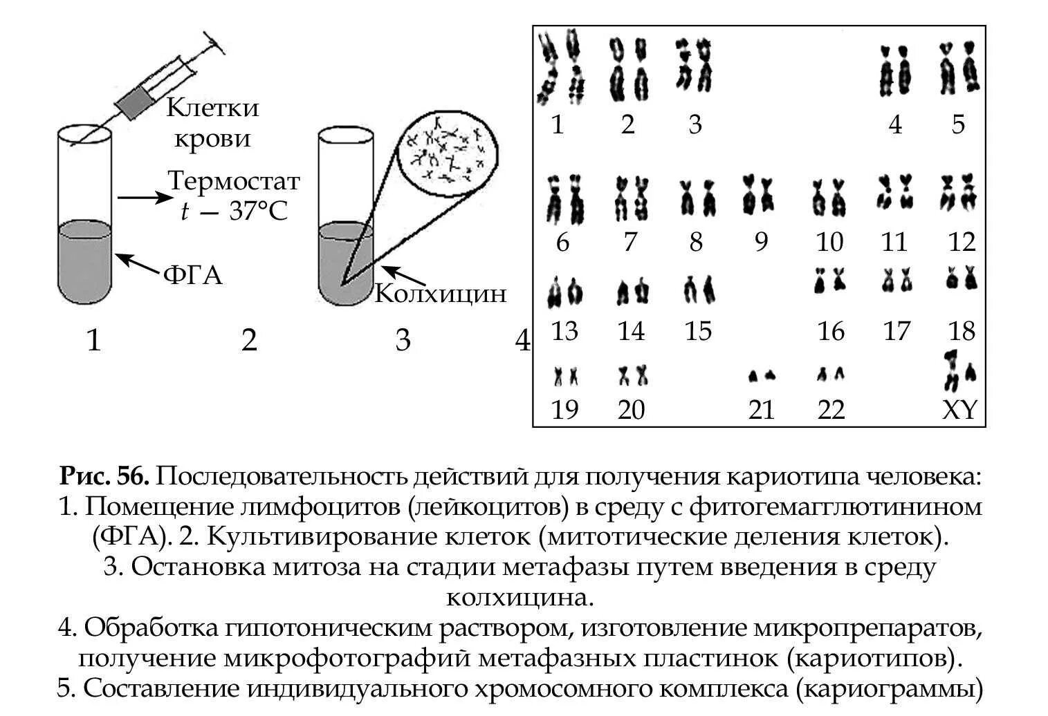 Кариотип человека определяют