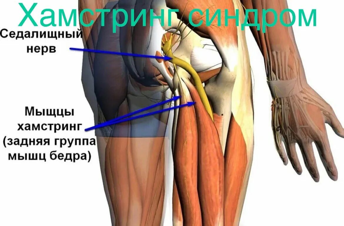 При ходьбе отдает в левую ягодицу