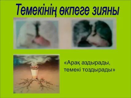 Зияны бар ма