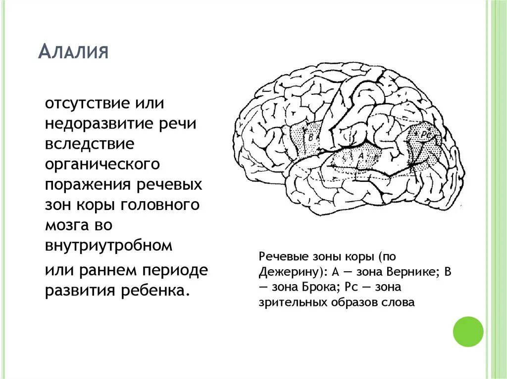 Речь при поражении коры головного мозга. Зона брока. Локализация поражения при моторной алалии. Зона вернике. Речь при поражении коры головного мозга.