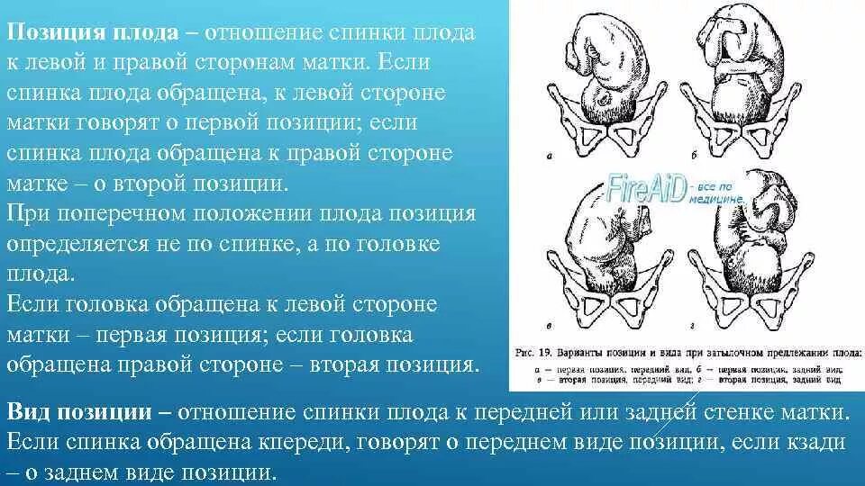 Спинка плода спереди слева. Положение плода первая позиция. Расположение плода с позициями. Позиция плода это отношение спинки. Положение плода продольное предлежит головка