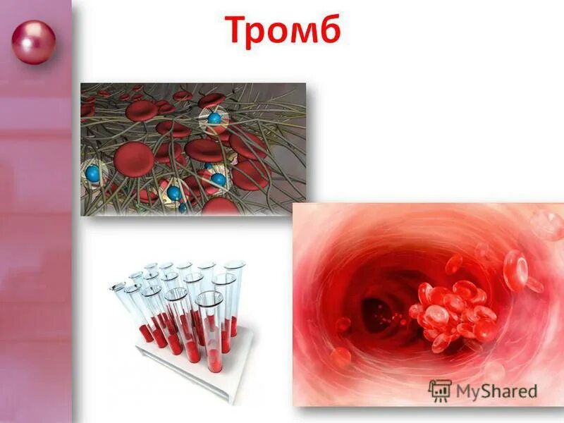 Лейкоциты, фагоциты, антитела. Тромбоциты эритроциты лейкоциты миоциты. Строение эритроцитов лейкоцитов и тромбоцитов. Эритроциты и лейкоциты и антитела. В лимфатических узлах лимфа насыщается лейкоцитами эритроцитами.