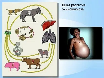 Эхинококк заражение
