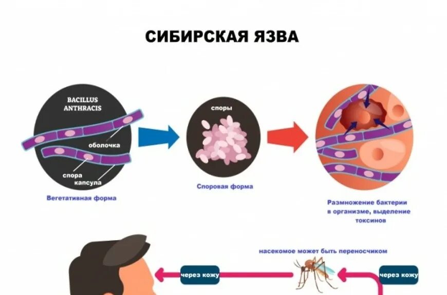 Сибирская язва пути передачи. Bacillus anthracis источник инфекции. Клиника сибирской язвы