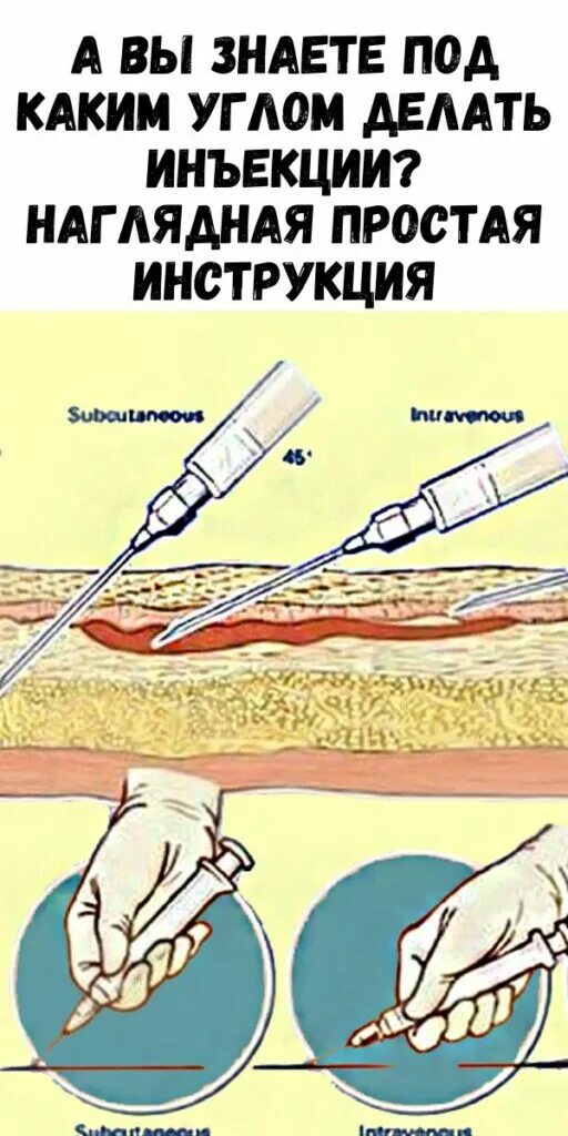 Под каким углом вводить. Инъекции. под каким углом делать укол. углы введения инъекций.