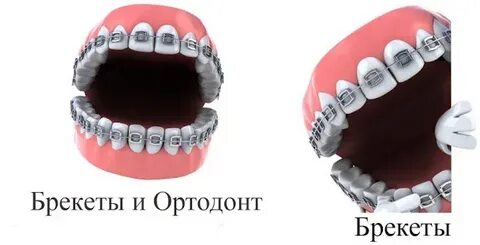 Сколько зарабатывает ортодонт
