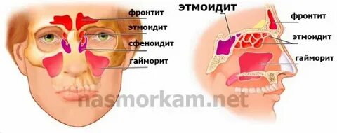 Воспаление решетчатой