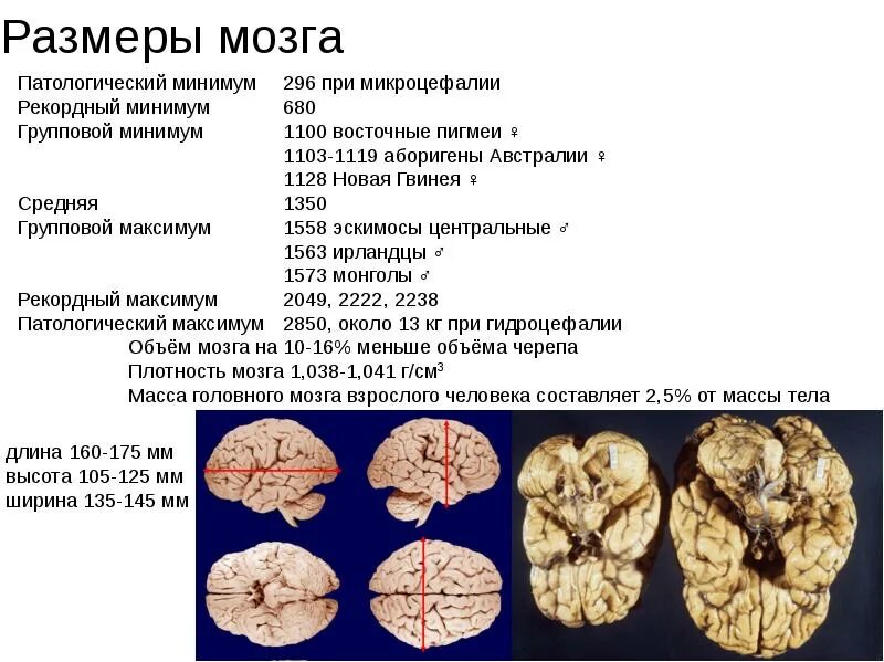 Относительные размеры мозга. Объем мозга. Объем мозга человека. Объем мозга современного. Размер мозга современного человека.