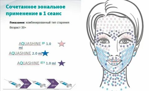 Точки мезотерапии