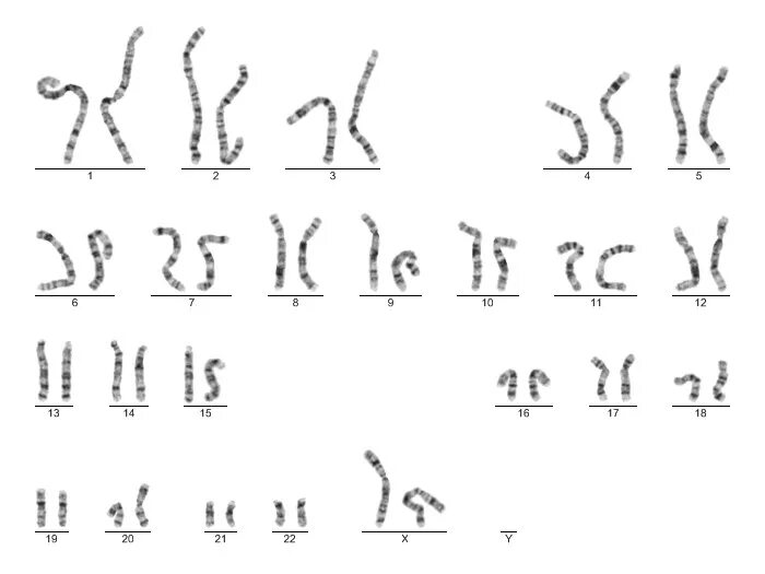 Кариотипирование супругов цена. Кариотипирование исследование. Цитогенетическое исследование на кариотип расшифровка результатов. Кариотипирование эмбриона. Результат кариотипирования.