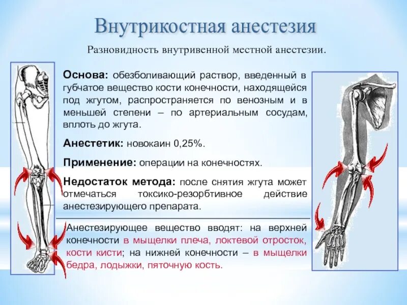 Блокада противопоказания. Внутрикостная инъекция алгоритм. Внутрикостная анестезия. Методика внутрикостной анестезии. Внутрикостная анестезия осложнения.