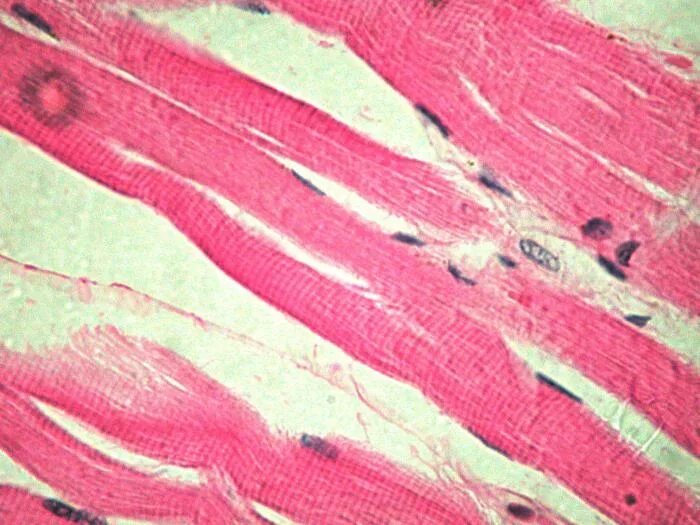 Гладкие мышцы многоядерные. Гладкая мышечная ткань микропрепарат. М'Язова тканина. Поперечно полосатая мышечная ткань ткань. Поперечно полосатая мышечная ткань микрофотография.