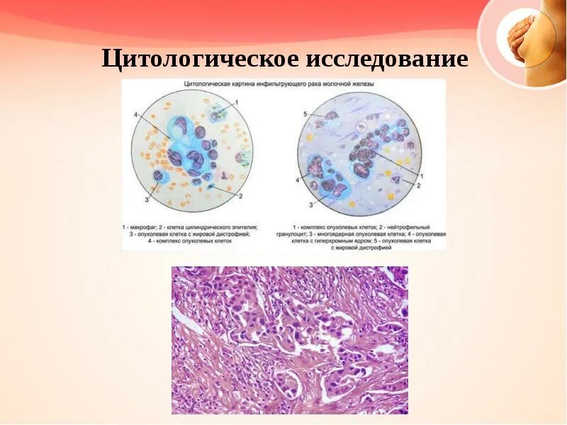 Цитологический метод примеры. Цитологический метод исследования. цитологическое исследование это исследование. цитологическая лаборатория исследует. цитологические методы исследования в онкологии.