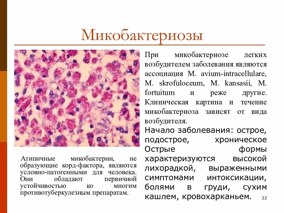 Атипичные микобактериозы. Микобактериоз поражение легких. Нетуберкулезный микобактериоз гистология. Нетуберкулезные микобактерии микробиология. Нетуберкулезный микобактериоз