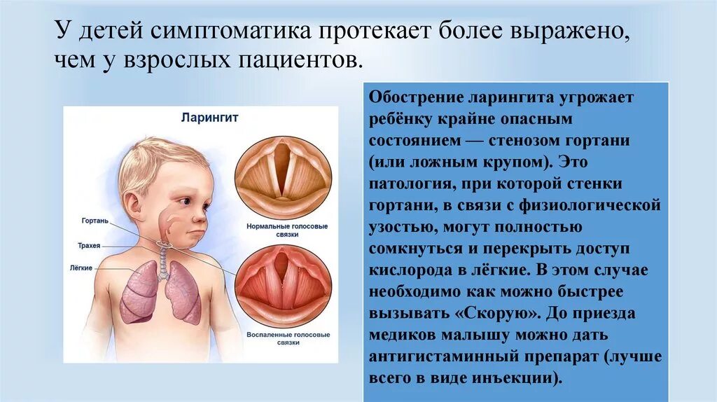 Ларингит у детей симптомы. Ларингит симптомы у детей симптомы.