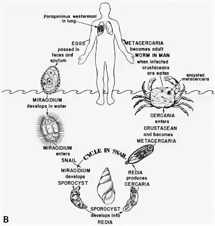 Жизненный цикл легочного сосальщика. Цикл развития легочного сосальщика рисунок. Легочный сосальщик жизненный цикл. Легочный сосальщик жизненный цикл. Цикл развития легочного сосальщика.