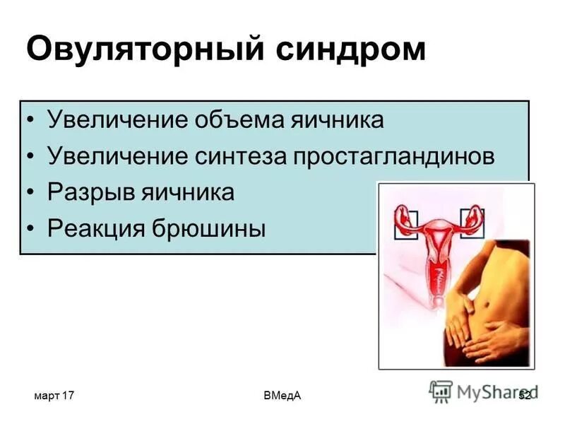 острый живот. мкб 10 разрыв яичника. апоплексия яичника клиника диагностика лечение. мкб 10 разрыв яичника.