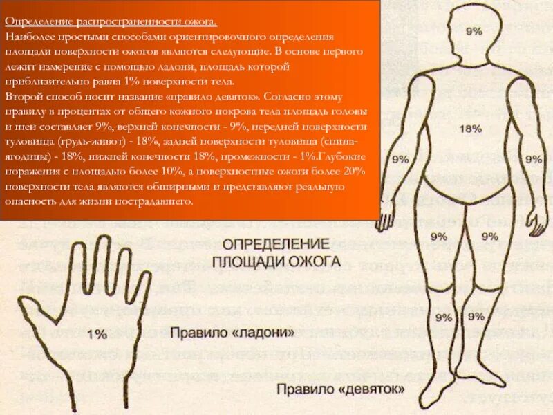 Опасные для жизни ожоги площадью. Площадь ожоговой поверхности. Способы определения площади ожога. Оценка ожоговой поверхности. Методы определения ожоговой поверхности.